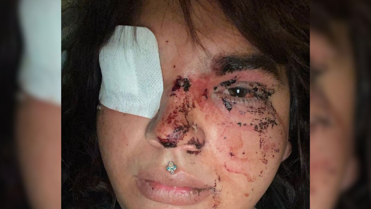 Cinco detenidas por la paliza a Miss Trans Zamora en León
